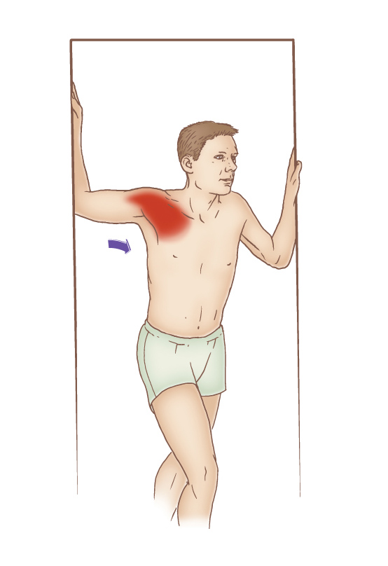 Self-care pectoralis stretch performed in a doorway. Permission: Joseph E. Muscolino, The Muscle and Bone Palpation Manual (2016), Elsevier.
