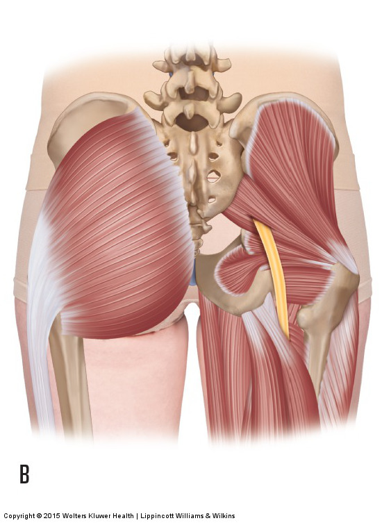 Common anomaly of the sciatic nerve passing through the piriformis muscle. Permission: Joseph E. Muscolino. Manual Therapy for the Low Back and Pelvis (2015).