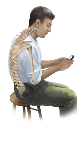 Slumped posture is often caused by collapsing the upper body forward to use digital devices. Permission: Joseph E. Muscolino. 