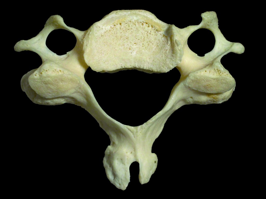 Cervical vertebra (typical) - Learn Muscles
