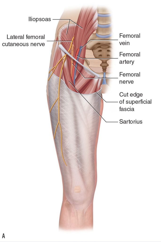 lateral femoral cutaneous nerve