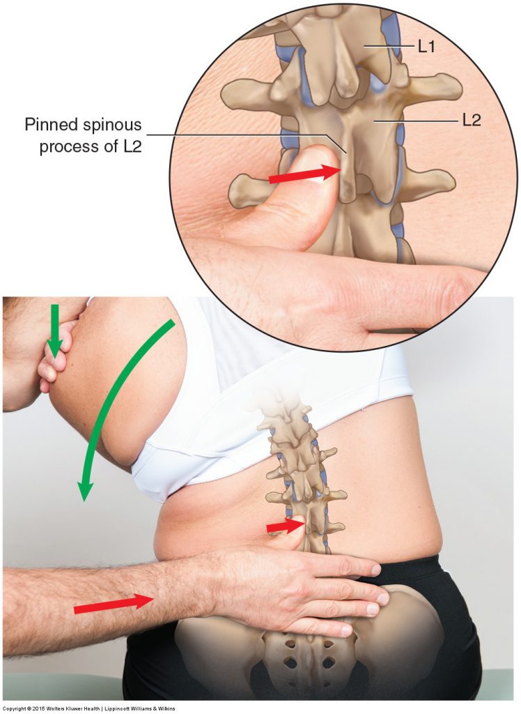 Motion palpation of the lumbar spine seated.